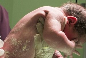 vacuumpomp, tangverlossing, knip