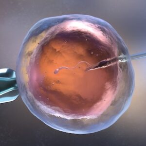 IVF
