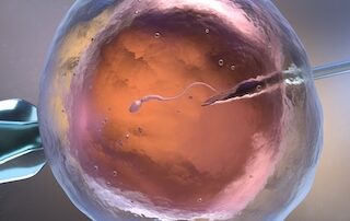 IVF