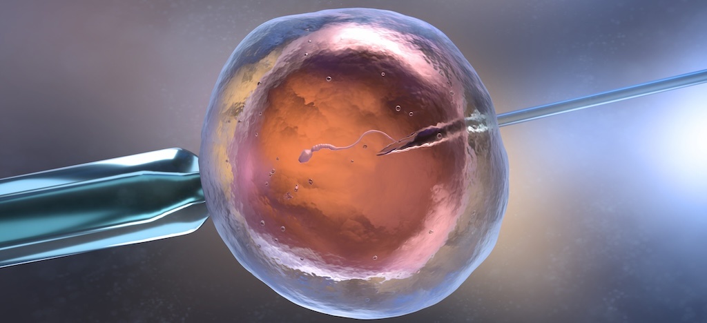 IVF